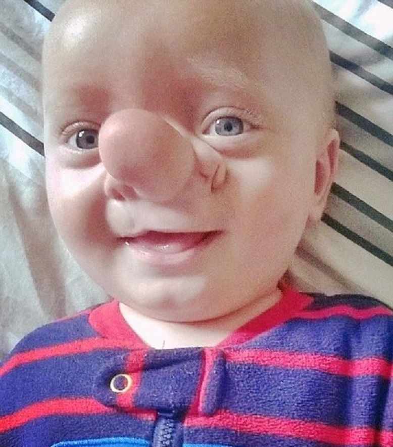 Mózg znalazł się poza czaszką. "Kiedy go zobaczyłam, odebrało mi mowę"