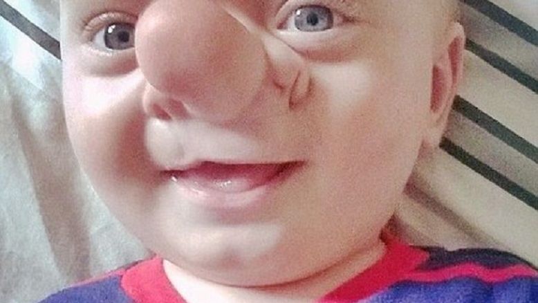 Mózg znalazł się poza czaszką. "Kiedy go zobaczyłam, odebrało mi mowę"