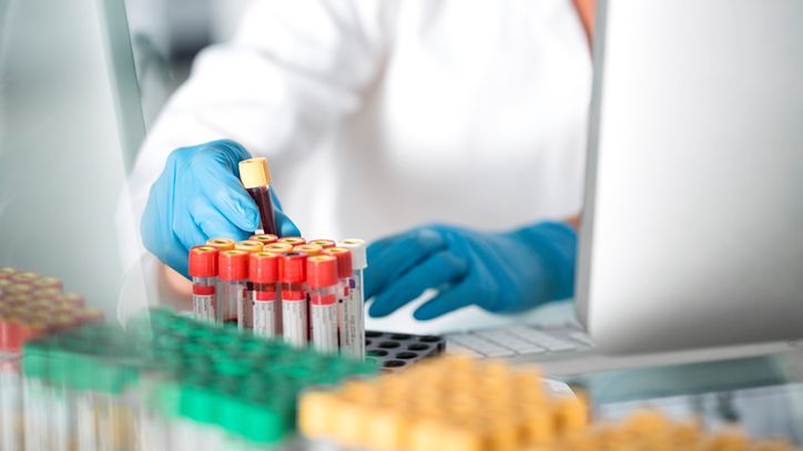 Transaminazy to enzymy, których wartość można określić na podstawie próbki krwi.