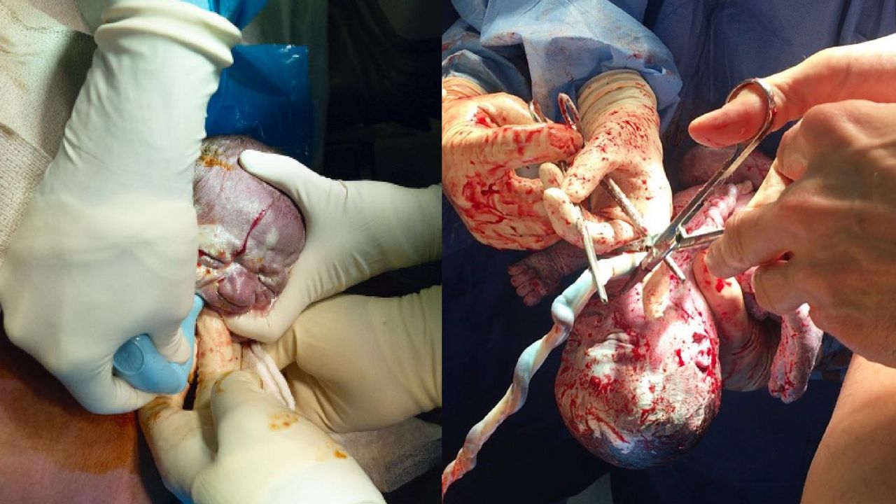 Sesja z porodu Terry Richardson