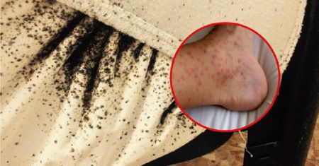8-latka ciągle się drapała. Pies od razu wyczuł przyczynę