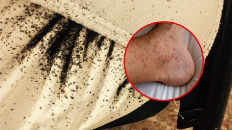 Dziecko swędziała skóra. Przyczynę odkrył pies