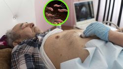 Jeden z czynników raka żołądka. "Rodzice w spadku przekazują nam bakterię"