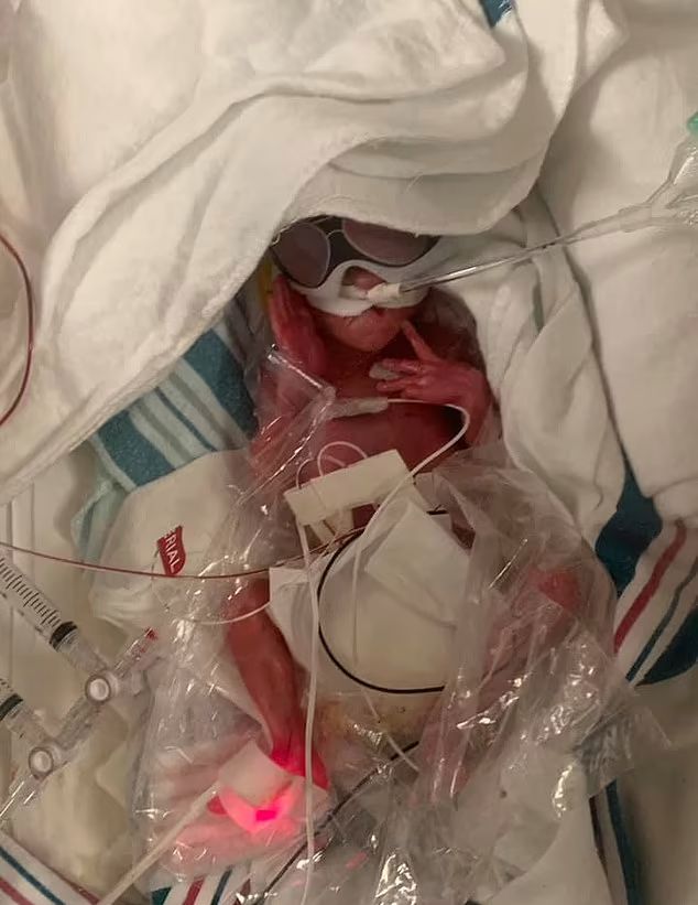 Cian miał dziewięć procent szans na przeżycie