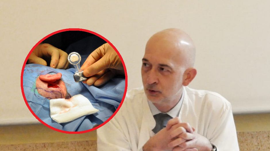 Zmieniają dźwięki w kostne wibracje. Wszczepili implanty po raz pierwszy w Polsce