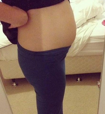 Sherie Hagger: Na poczatku objawy były specyficzne m.in. wzdęty brzuch oraz częste biegunki