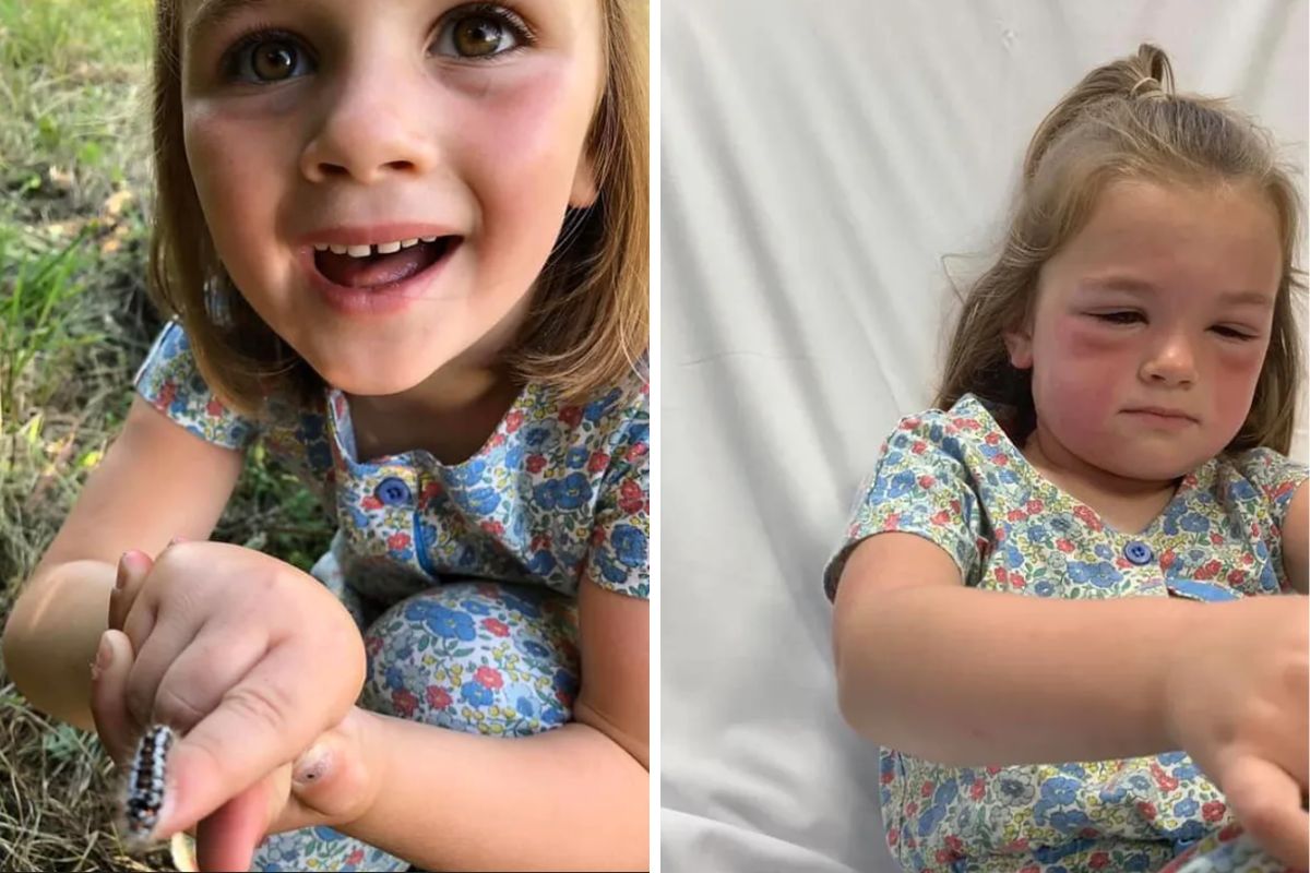 Wystarczył krótki kontakt z gąsienicą