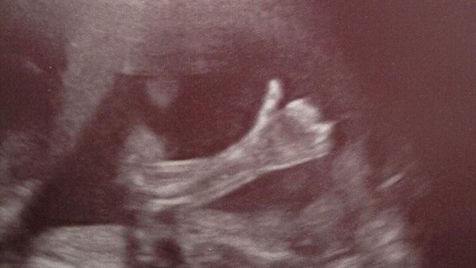 Dziecko w łonie matki z kciukiem w górze