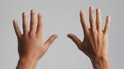 Obrzęk i opuchlizna - przyczyny powstawania, leczenie, jak długo się utrzymuje?