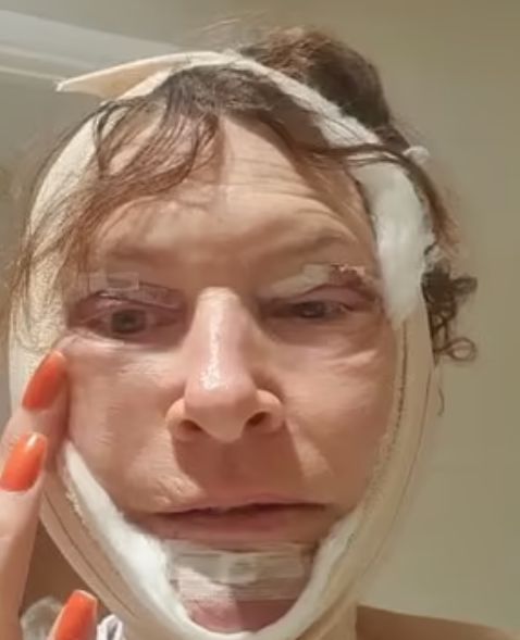 Kobieta będzie musiała przejść zabieg korygujący 