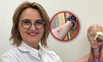 Na jej nodze pojawiła się swędząca gruda. "Jestem weteranką boreliozy"