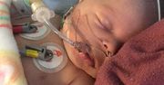 Noworodek przeszedł trzy zawały po tym, jak zachłysnął się mlekiem