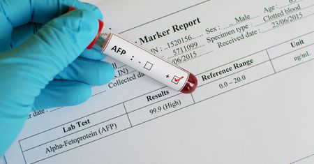 AFP - normy, interpretacja wyników