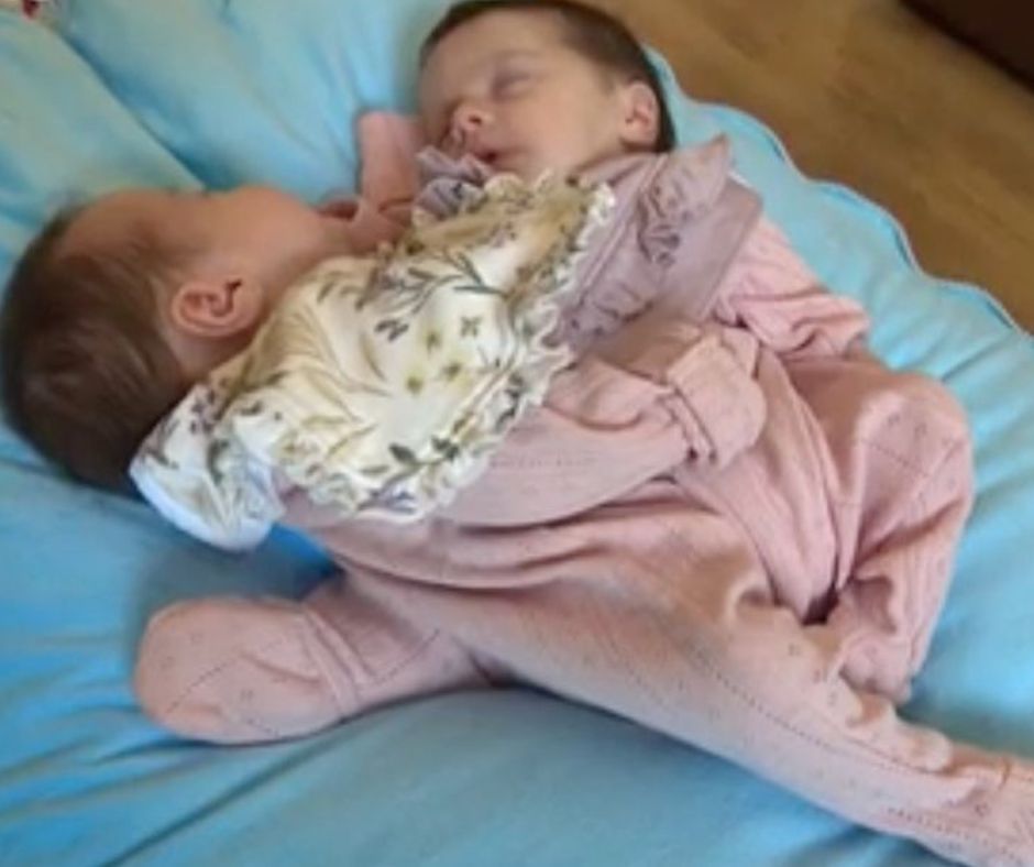 Annabelle i Isabelle to bliźniaczki syjamskie