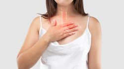 Manometria przełyku - przebieg badania, wskazania i przeciwwskazania