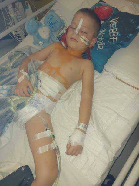 Antoś przeszedł już kilkadziesiąt zabiegów