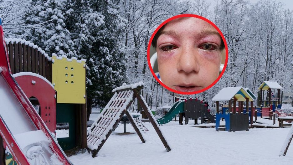 Chłopiec był o krok od udaru. Wszystko przez popularną "zabawę"