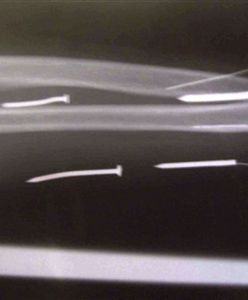 Szef ukarał pracownicę - wbił jej 24 gwoździe w ciało