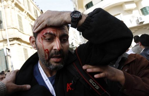 Straszeni bronią i ranni - dziennikarze w Egipcie