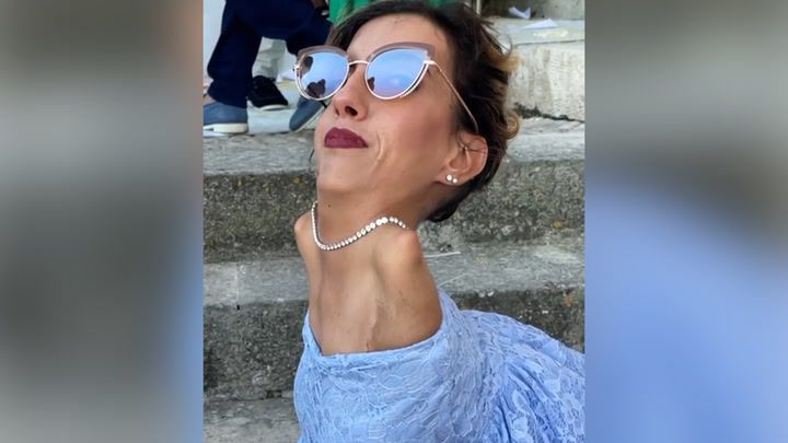 Nadia urodziła się bez rąk, ale to nie przeszkodziło jej, by żyć pełnią życia.