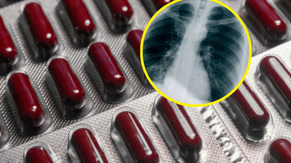 Obiecujące badania nad witaminą B3. Lekarze jednak apelują: warto na nią uważać