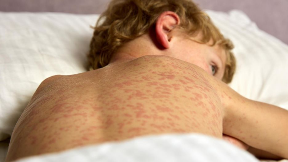 5 niepokojących dolegliwości u dziecka