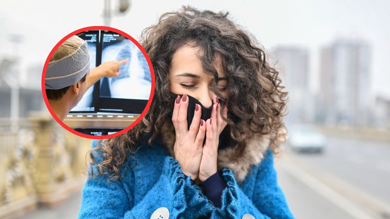 Rak płuc coraz częstszy. Nie trzeba palić, by zachorować