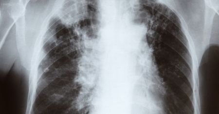 Spirometria nie boli, a ratuje życie