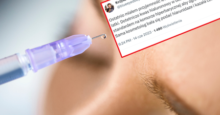 Wstrzyknęła kwas w czoło. Doszło do martwicy
