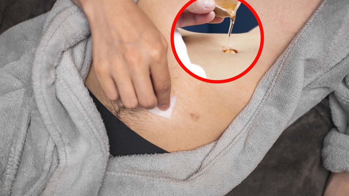 Olej rycynowy w pępku. Czy działa?