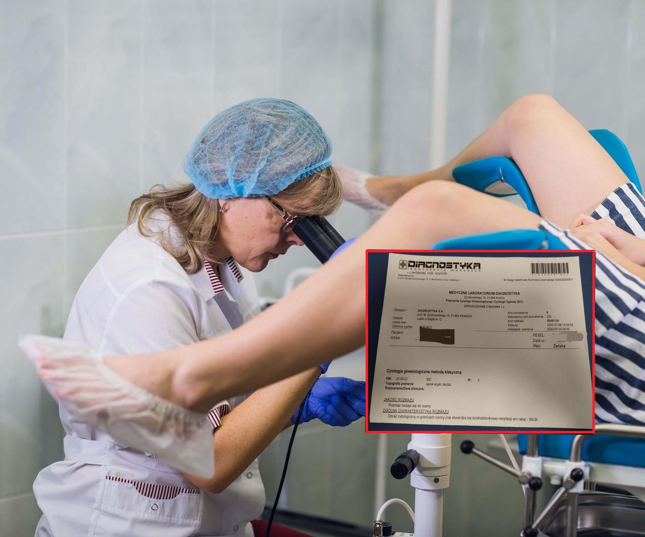 Jeden z głównych "zabójców" Polek. Sama cytologia może nie wystarczyć