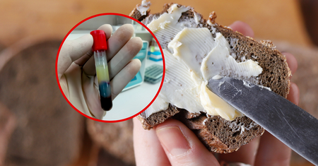 W tętnicach działa jak miotła. Zbija cholesterol, wymiata złogi