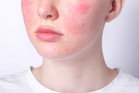 Cera wrażliwa – charakterystyka, przyczyny, pielęgnacja