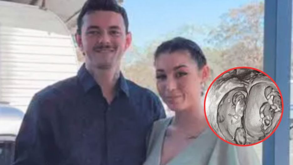 Niezwykła ciąża. "Prawie zemdlałam, gdy się dowiedzieliśmy"