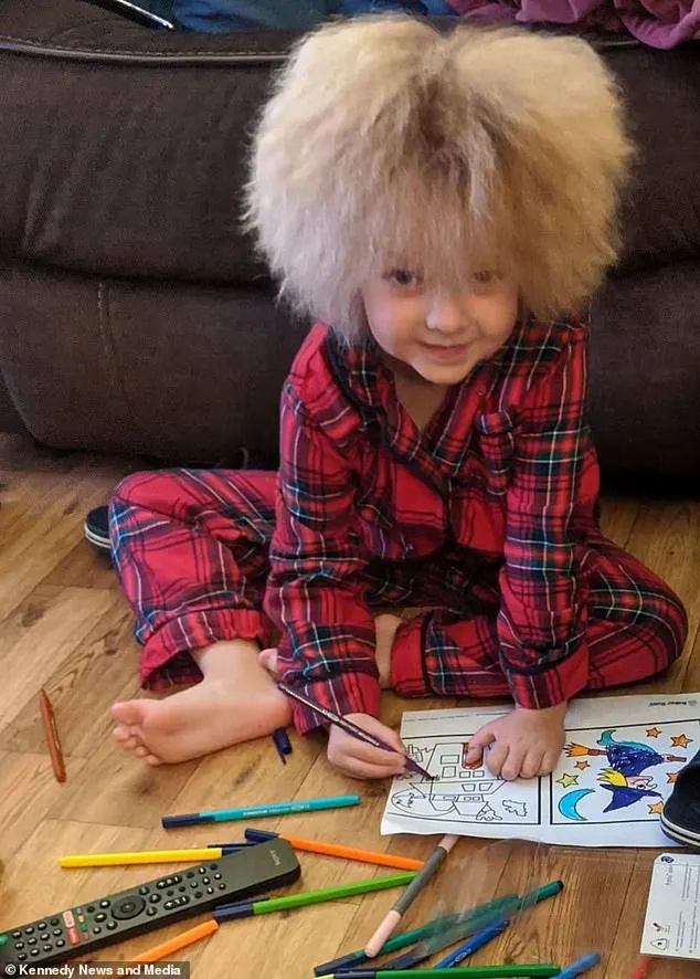 Florence cierpi na zespół włosów niedających się uczesać