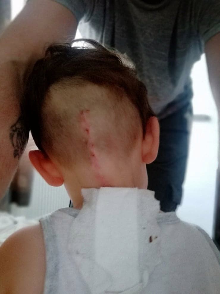 Chłopiec dobrze zniósł operację