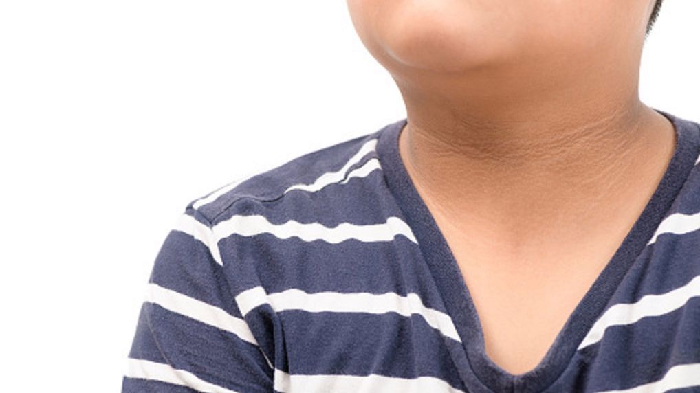 Rogowacenie ciemne. Ciemne plamy na skórze, które lepiej nie lekceważyć