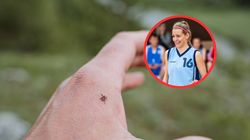 Coraz więcej chorych po ukąszeniach kleszczy. "Największym sukcesem jest to, że samodzielnie oddycha"