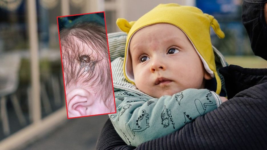 Przerażające zdjęcie dziecięcej główki. "Myślałam, że to jakiś organ"