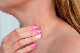 Wysypka na szyi – przyczyny, objawy i leczenie