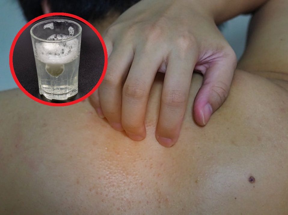 Mit, w który wierzono od lat. Naukowcy mówią o efekcie placebo
