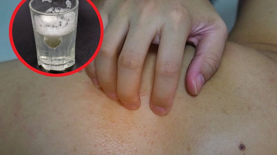 Stosujesz wapno na alergię? Według specjalistów to nie pomoże