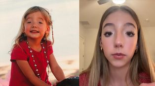 Do mrugania służą jej brwi. 19-latka opowiedziała o rzadkiej wadzie