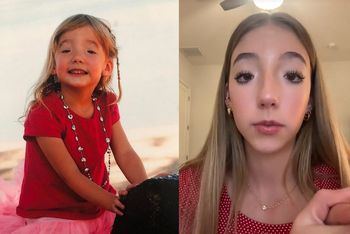 Do mrugania służą jej brwi. 19-latka opowiedziała o rzadkiej wadzie