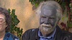 Srebrzyca- co to za choroba, przyczyny, leczenie