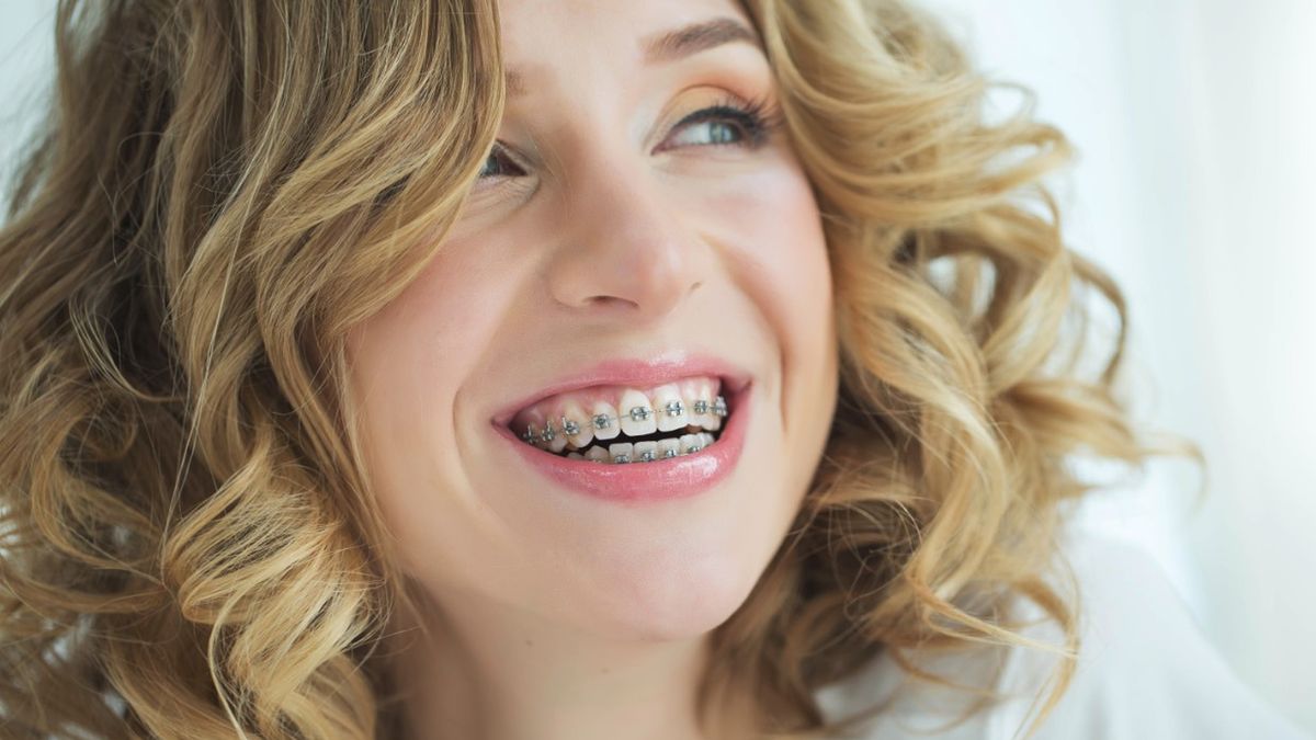 To, ile trwa leczenie ortodontyczne, jest kwestią indywidualna. W dużej mierze okres terapii zależy od: wieku pacjenta i rodzaju aparatu.