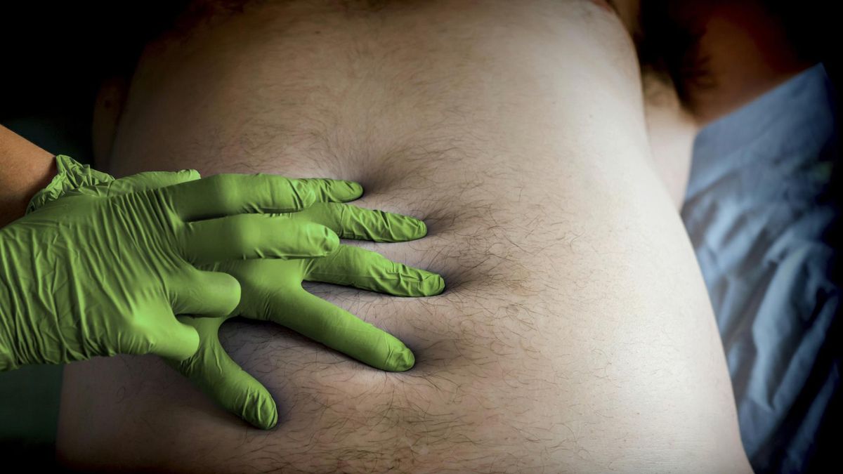 Mężczyzna skarżył się na ostry ból brzucha. Podczas operacji lekarze odkryli, że połknął kilka plastikowych opakowań