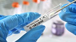 Nowy wariant "małpiej ospy" w Europie. Służby medyczne zalecają szczepienie