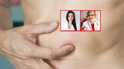 Zmiany na skórze zwiastują ukryte choroby. "Nie powinniśmy lekceważyć"