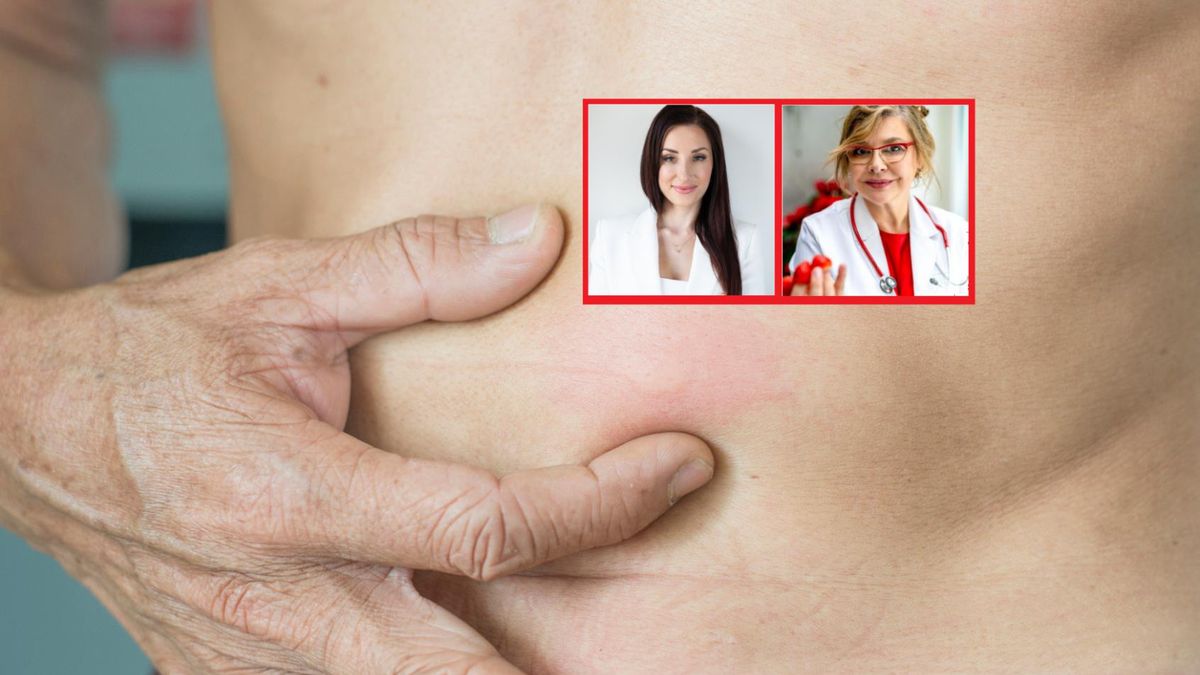 Objawy skórne są często pierwszymi sygnałami poważnej choroby